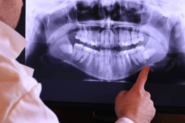Best Emergency Dental Surgery in Gifford, FL