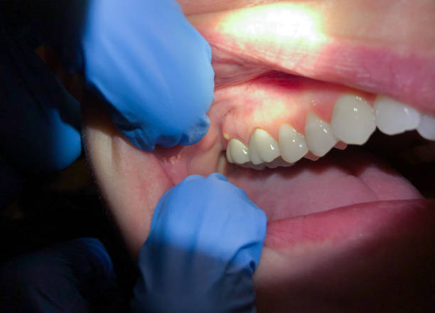 Best Emergency Orthodontic Repairs in Gifford, FL